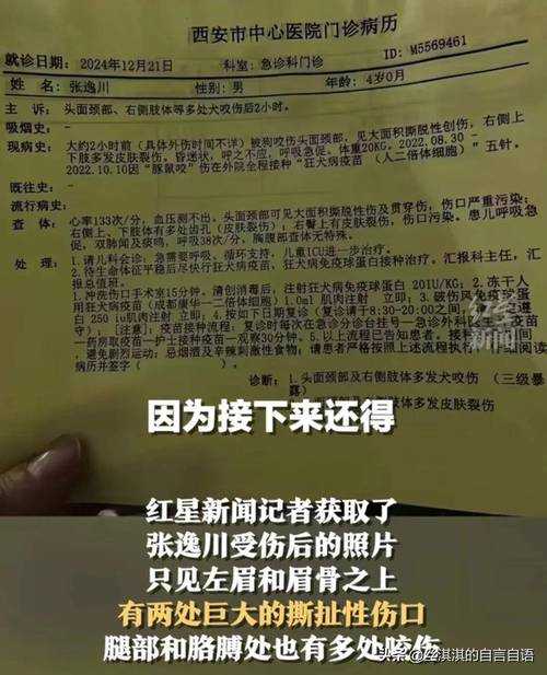 苹果派乡村精灵致幻声波引耳鸣事故